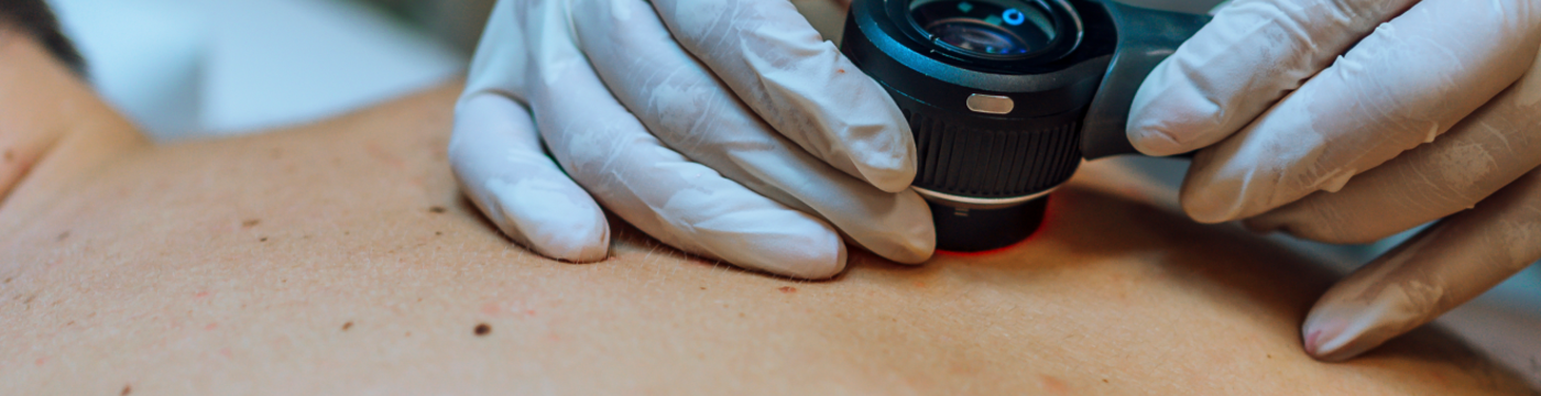 A physician looks through a hand-held lens at a lesion on a patient's back